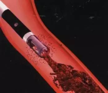 100升沙赫啤酒 产品图片