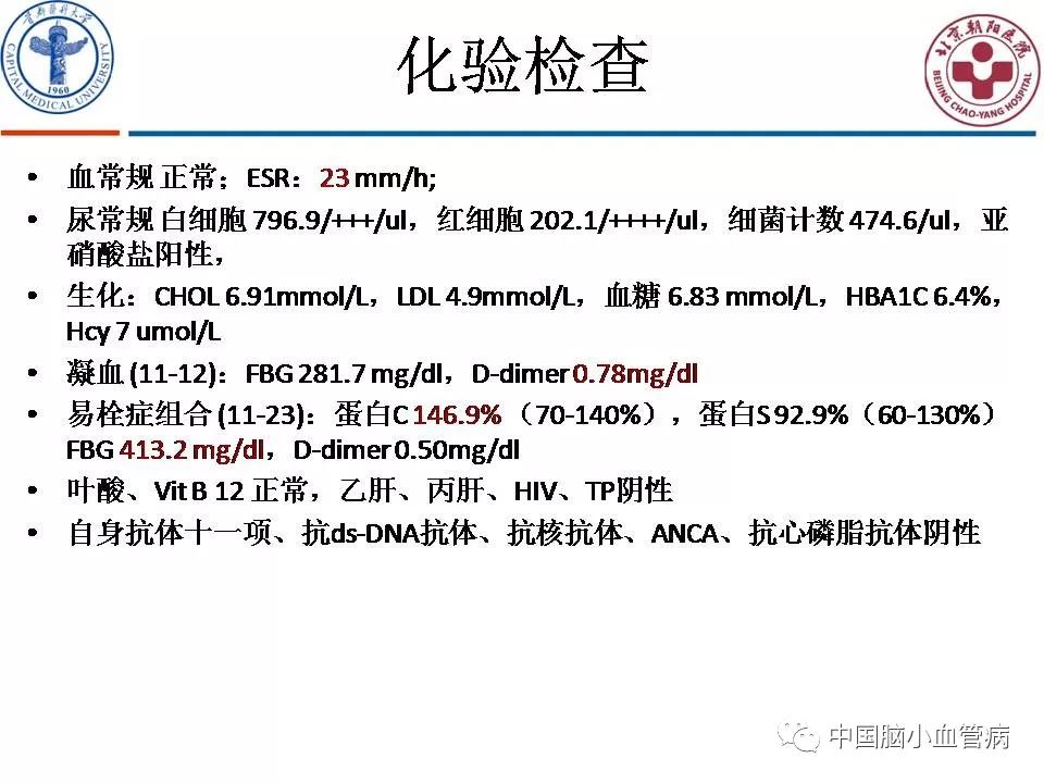 Smosh 大电影 视频主图
