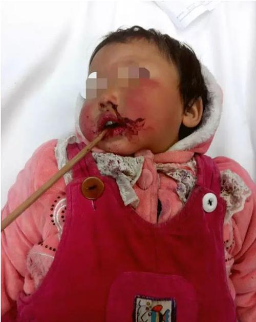 R2B：回到基地 推荐视频